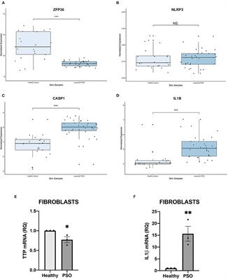 Promoter Methylation Leads to Decreased ZFP36 Expression and Deregulated NLRP3 Inflammasome Activation in Psoriatic Fibroblasts